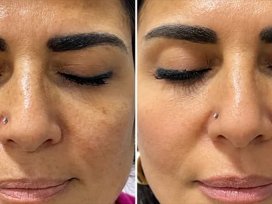 v-tech-system-before-and-after-image-3