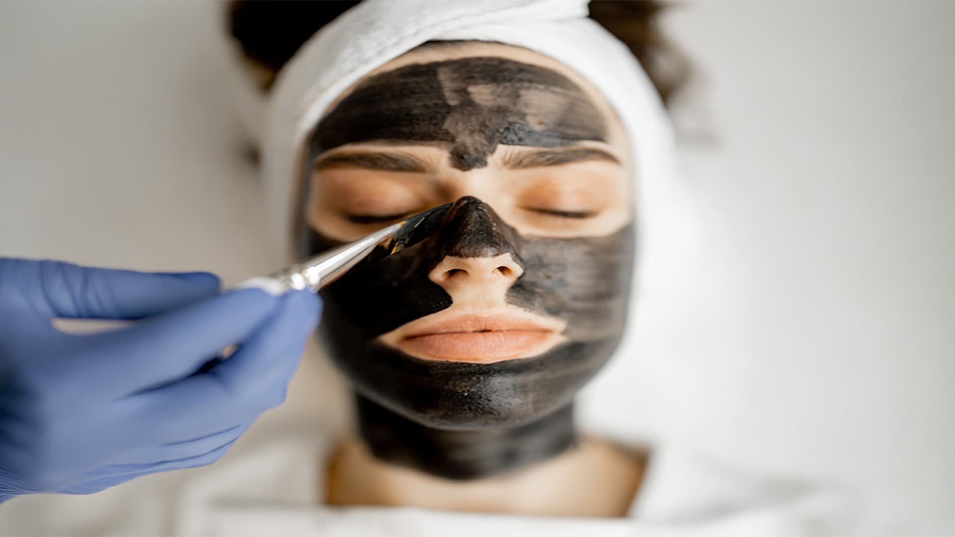 Carbon Laser Peel 