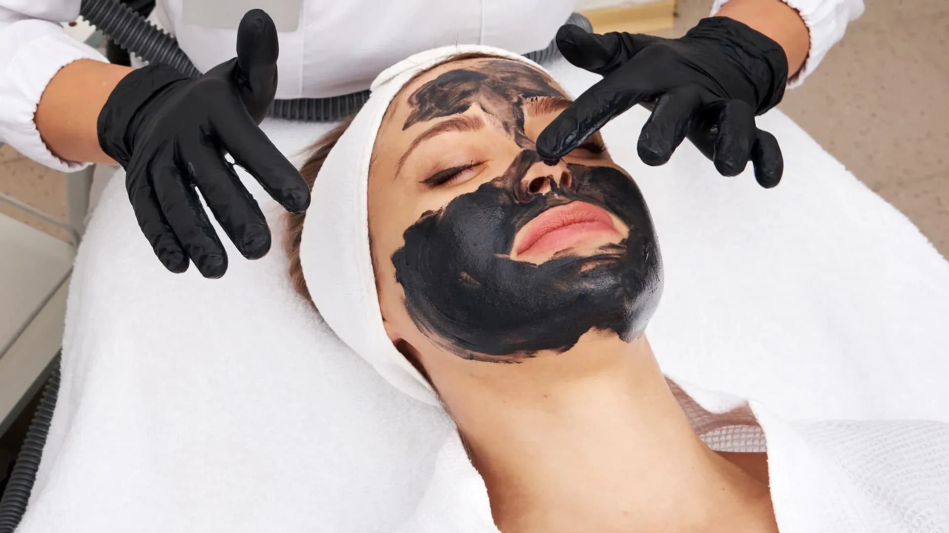 Chemical Peel for Face: Types, Benefits, and Recovery Guide