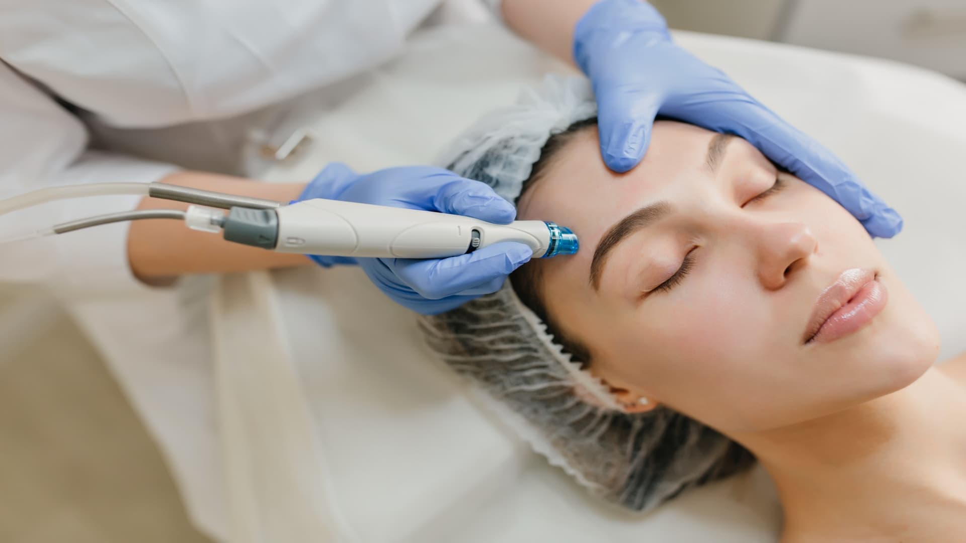 Laser Treatment for Pigmentation