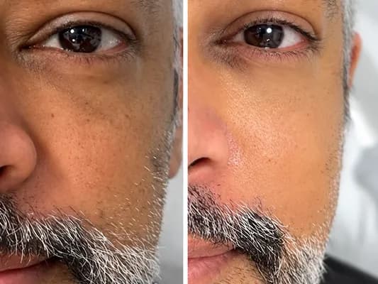 V-Carbon-System-before-and-after-image-1